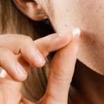 Madeca 21 Clear Spot Cure Patch (24 unidades) – Centellian 24 - Imagen 2